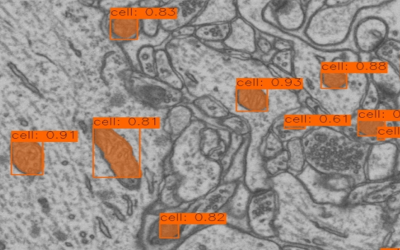 Analyzing Electron Microscopy with YOLO 11 in LabVIEW: A Promising Advancement in Automated Segmentation