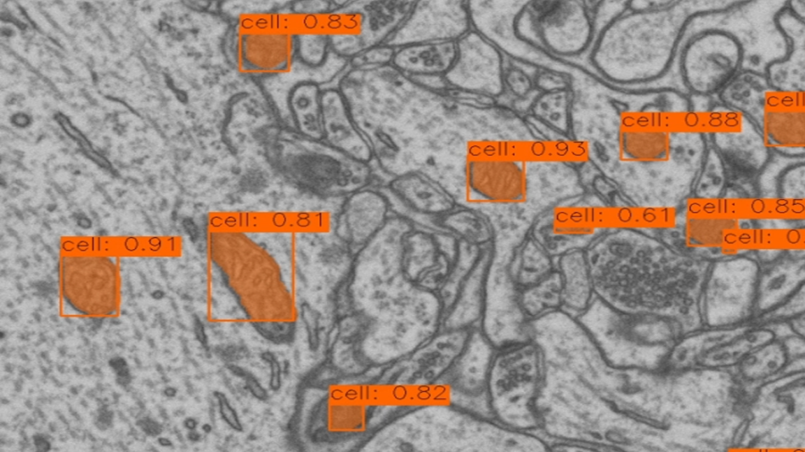 Analyzing Electron Microscopy with YOLO 11 in LabVIEW: A Promising Advancement in Automated Segmentation